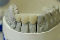 Die professionelle Vorsorge ist ein wichtiger Bestandteil der Zahntherapie bei Zahnarzt Dr. med. dent. Armin Eisermann in Blaustein.