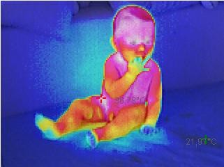 Wärmebild Thermografie Oldenburg Medizienisch