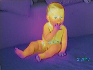 Thermobild Baby 50% Wärmebild Thermografie
