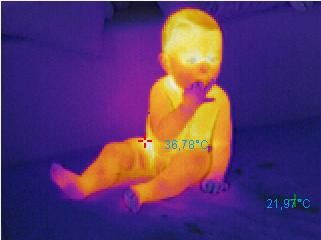 Wärmebild Baby 75%IR Thermobild Thermografie